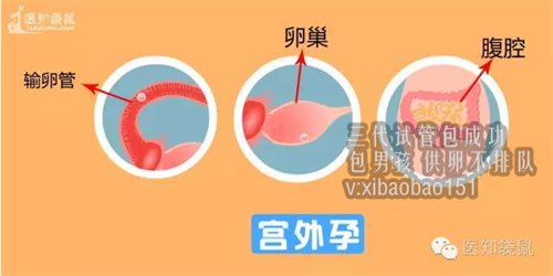 45岁郑州供卵自怀成功率多少_试管婴儿和普通婴儿有啥区别？郑萌珠的现状，让